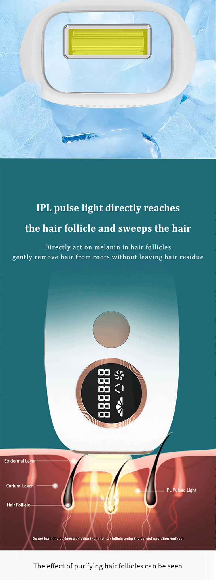 T27S IPL hair removal